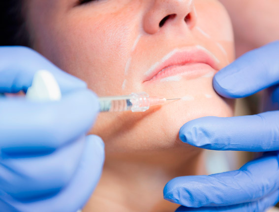 Hyaluron Filler Teosyal