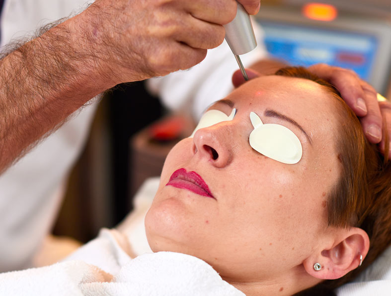 Revlite Lasertoning