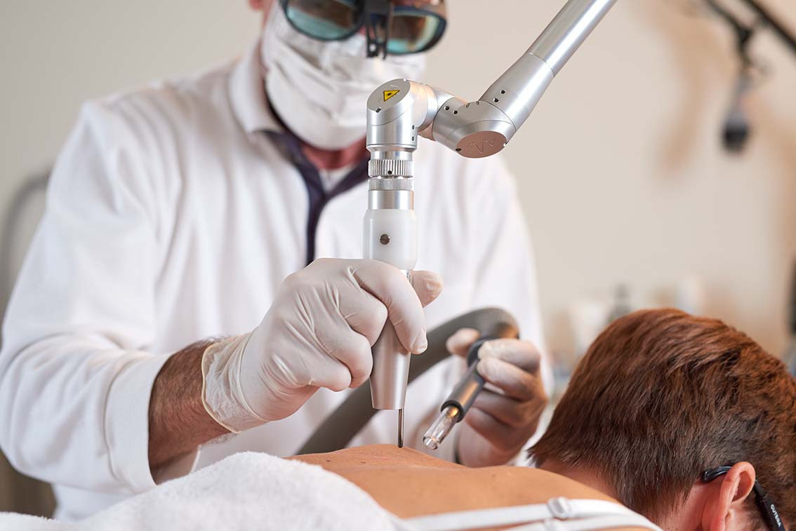 Neues Gesetz für die Tattooentfernung  zum Schutz der Patienten.