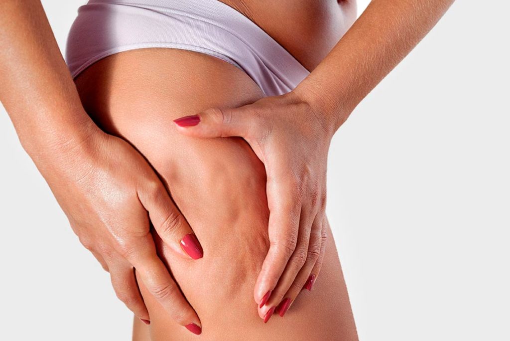 cellulite behandlung zürich