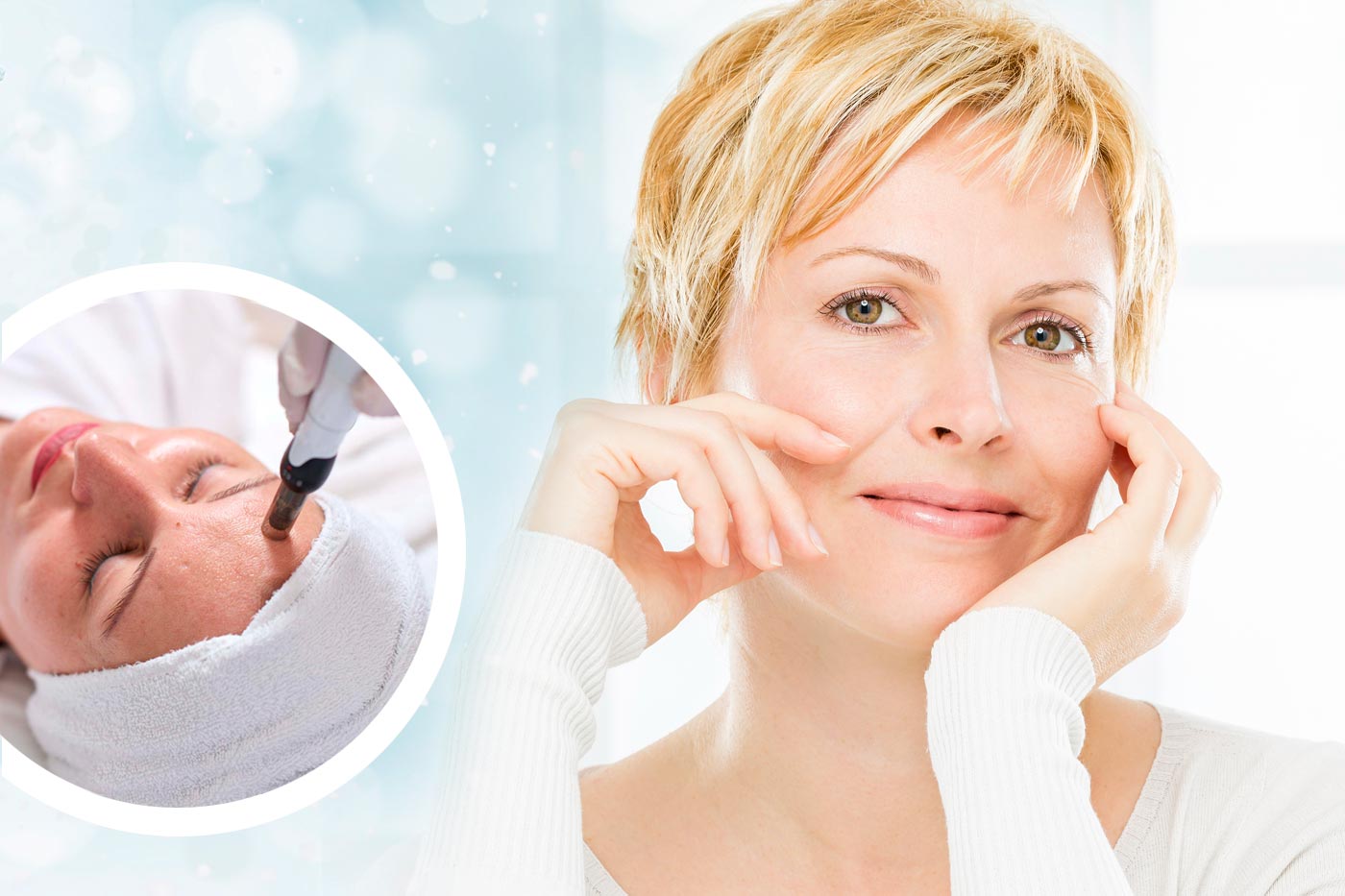 Winter Special: 20% auf das Microneedling mit PRP