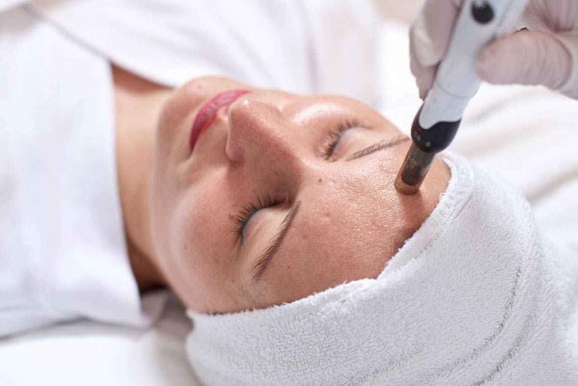 Microneedling ist nicht gleich Microneedling! Wir klären auf.