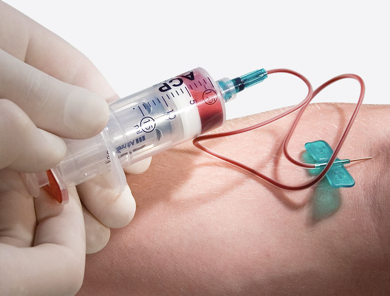prp microneedling