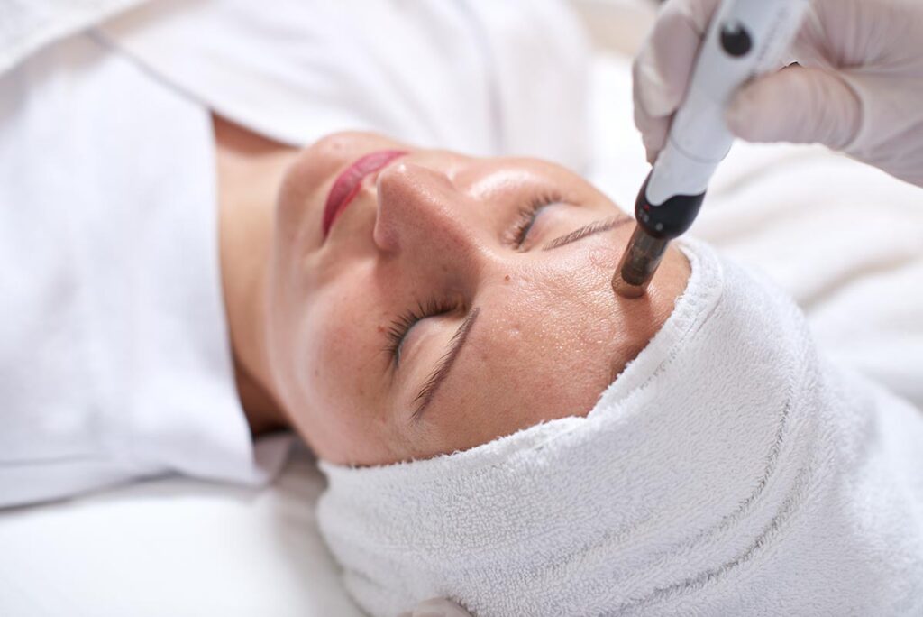 Microneedling